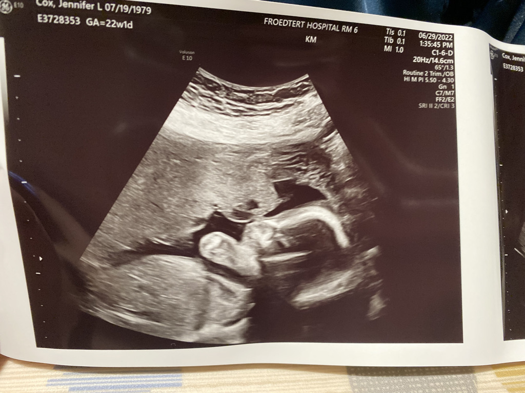 Anatomy Scan