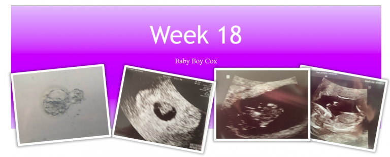 Week 18
