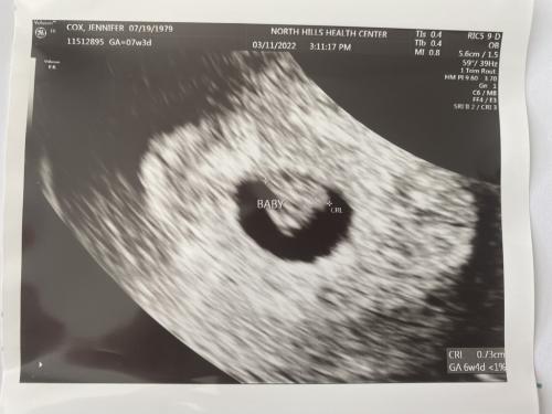 7 weeks