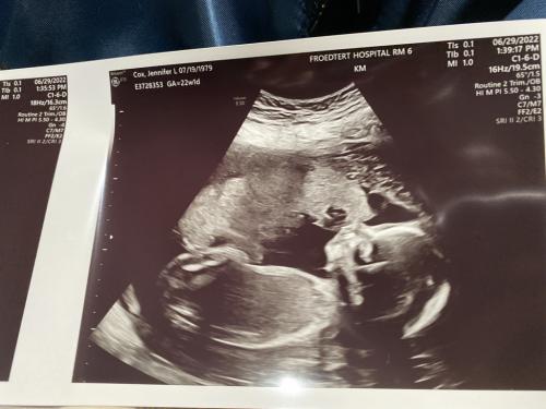 22 weeks