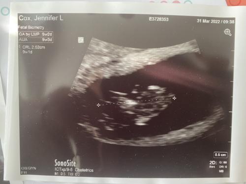 9 weeks
