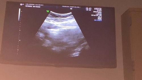 13 week