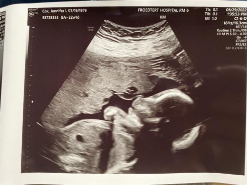 22 weeks
