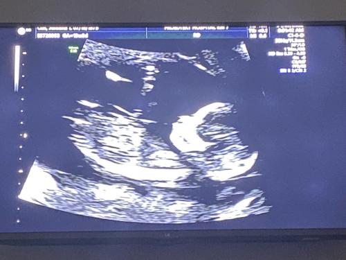 18 Weeks