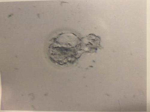 Fertilization