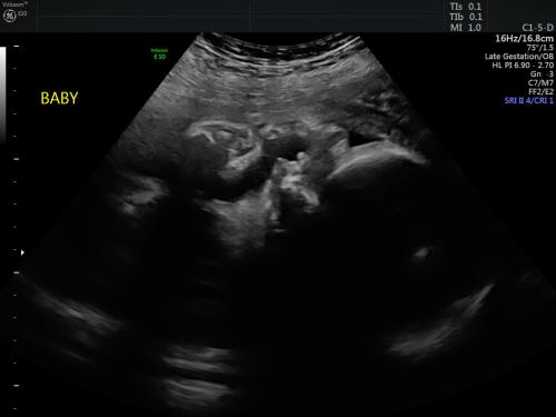 29 weeks