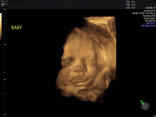 Baby Alien